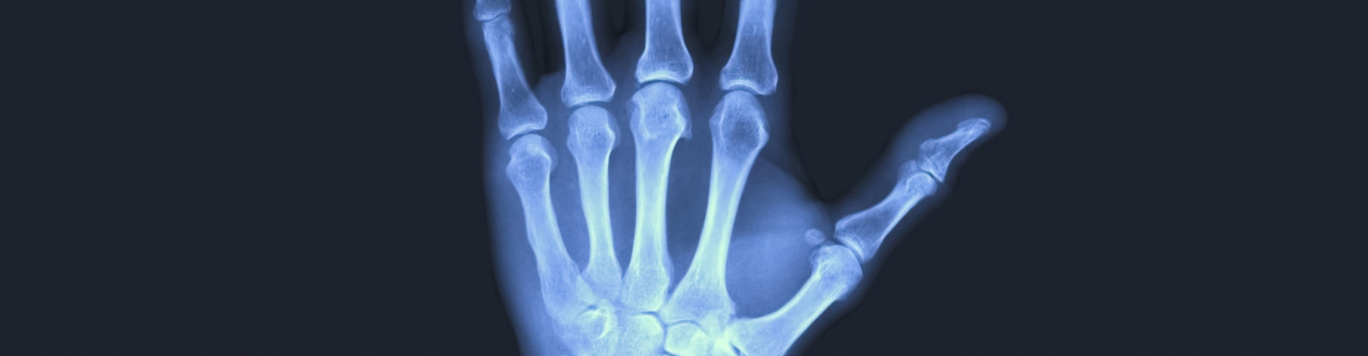 Baker's Gas X-Ray
